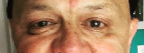 miracle monday: doctor, my eyes . . .